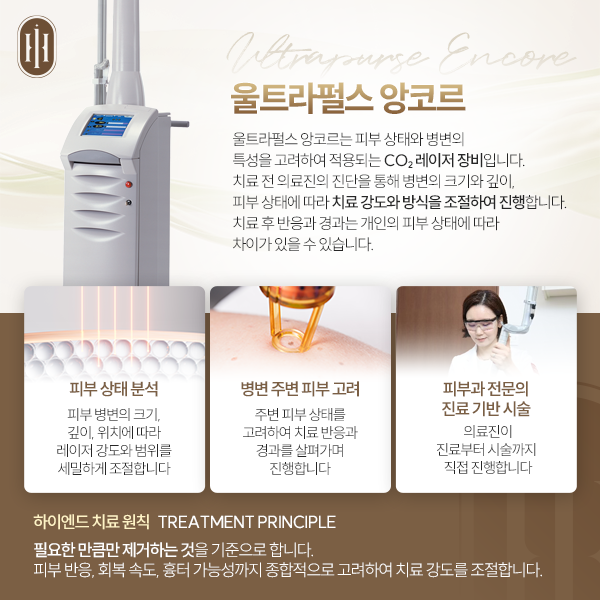 울트라펄스 앙코르